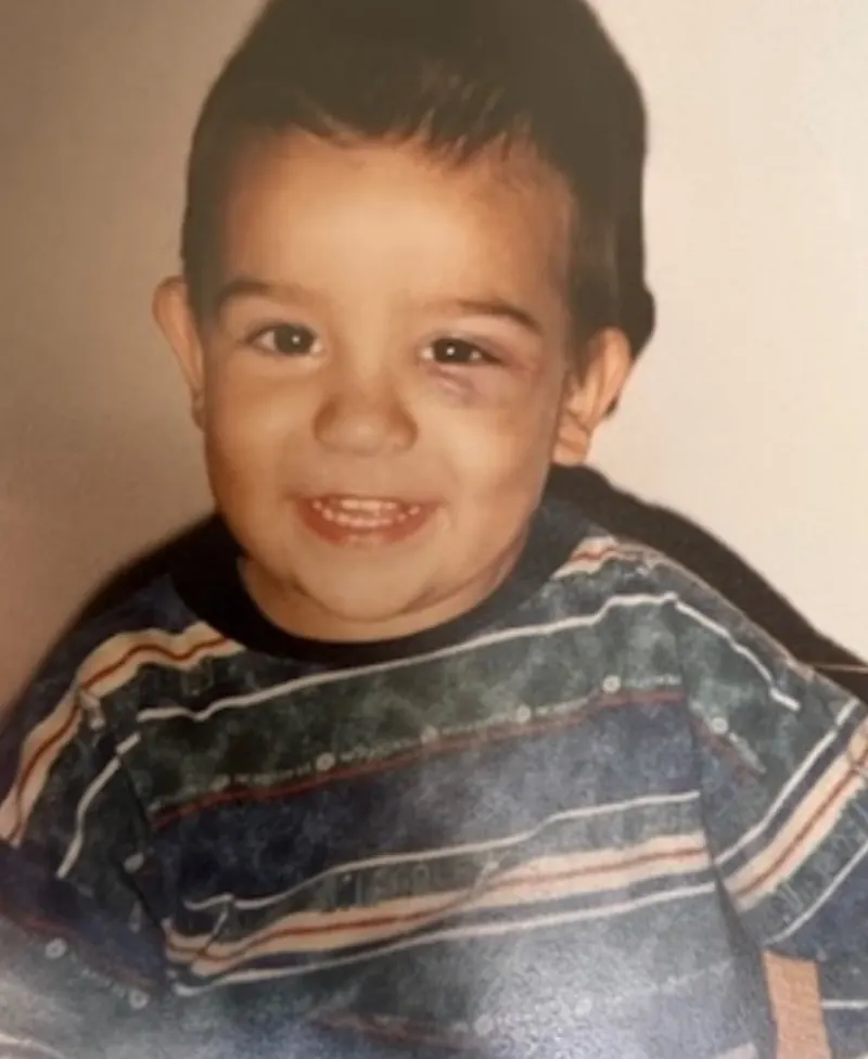 Cap Kuo de chico, sonriendo con un ojo morado